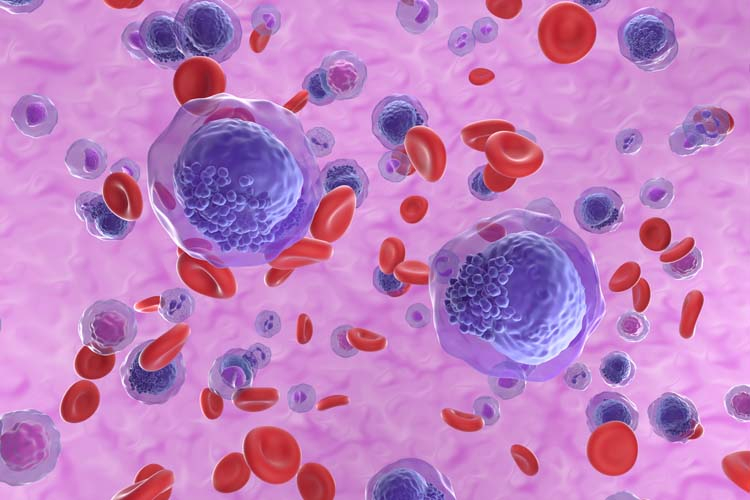 pharma_ninja's tweet photo. Leucemia mieloide cronica, conferme di beneficio clinico a lungo termine per ponatinib, a prescindere dallo stato mutazionale di BCR-ABL1. #EHA23
https://t.co/GbmHKpqyo7
#LEUCEMIA #ONCOLOGIA #EMATOLOGIA #PHARMANINJA #FARMANINJA https://t.co/feN6nQVGZ3