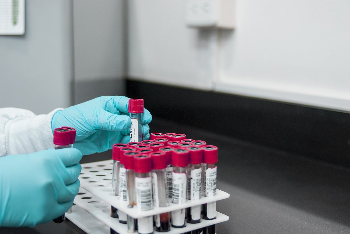 DataSaves_Lives's tweet photo. #Colon cancer is the second most common cancer in Europe however screening uptake is poor. In this #DataSaves case study, we learn how #HealthData is used to detect those at higher risk from routine blood tests that a patient has taken for other reasons: https://t.co/8OyaGXkPxR https://t.co/8SKsq2DGJB