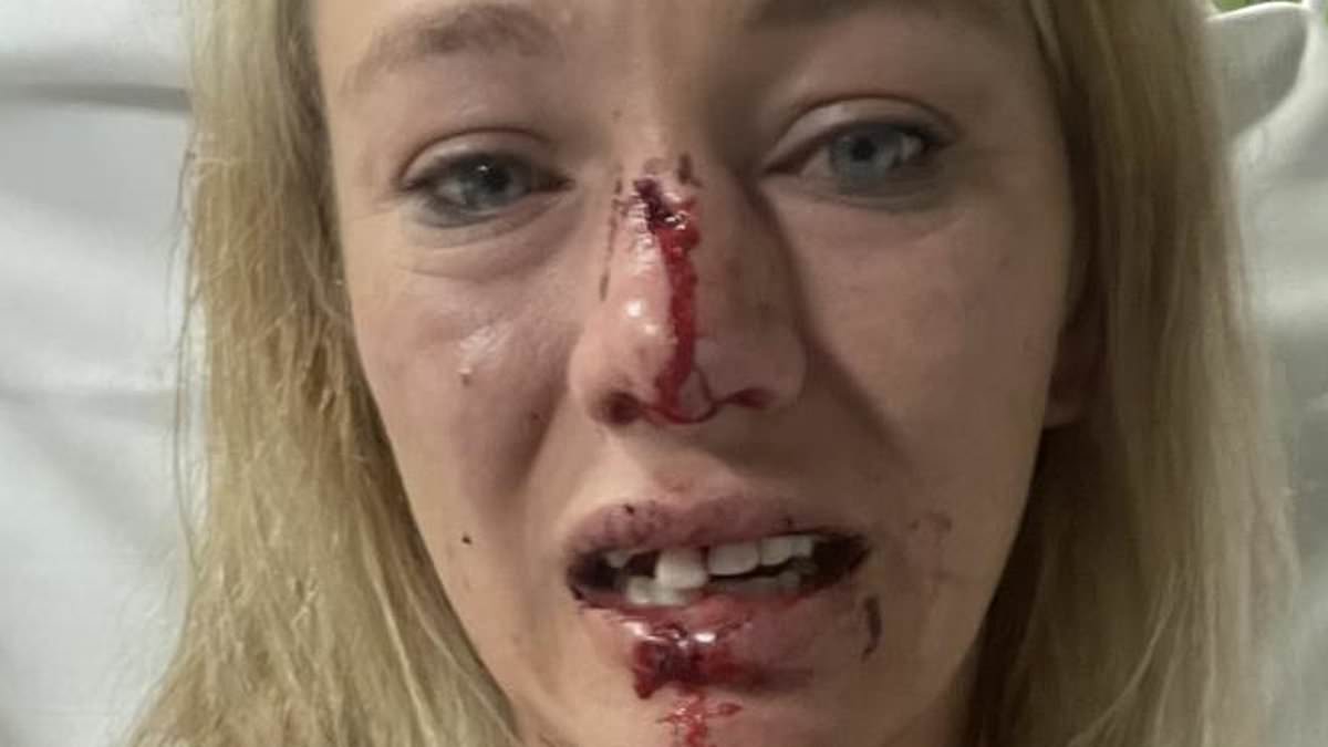 Top jockey Sonja Wiseman's gruesome injuries revealed after men smashed her face with a rock in Darwin carjacking just before her wedding