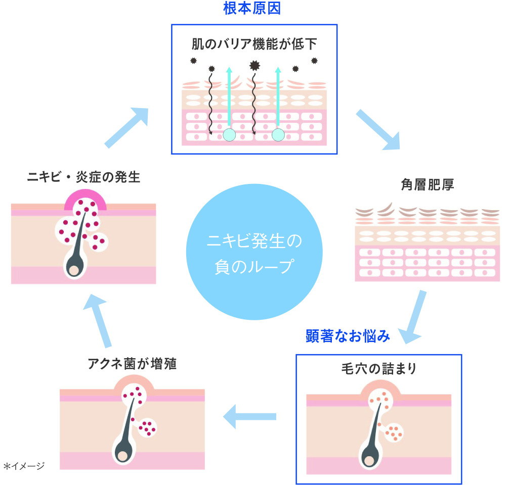 clearful_orbis's tweet photo. あっという間に8月ですね!🍉🌞🌻
8月は全国的にも平均温度は約30℃と真夏日が続きます🥵
7月に引き続きUV-Bが高く、その影響で毛穴が詰まりやすく、新たなニキビが発生しやすい状態になってしまいます。
ニキビが悪化する前に、集中&速攻ケアで肌を整えましょう💪✨
#お肌の夏期講習 #CLEARFUL https://t.co/3mmlWOrIyw