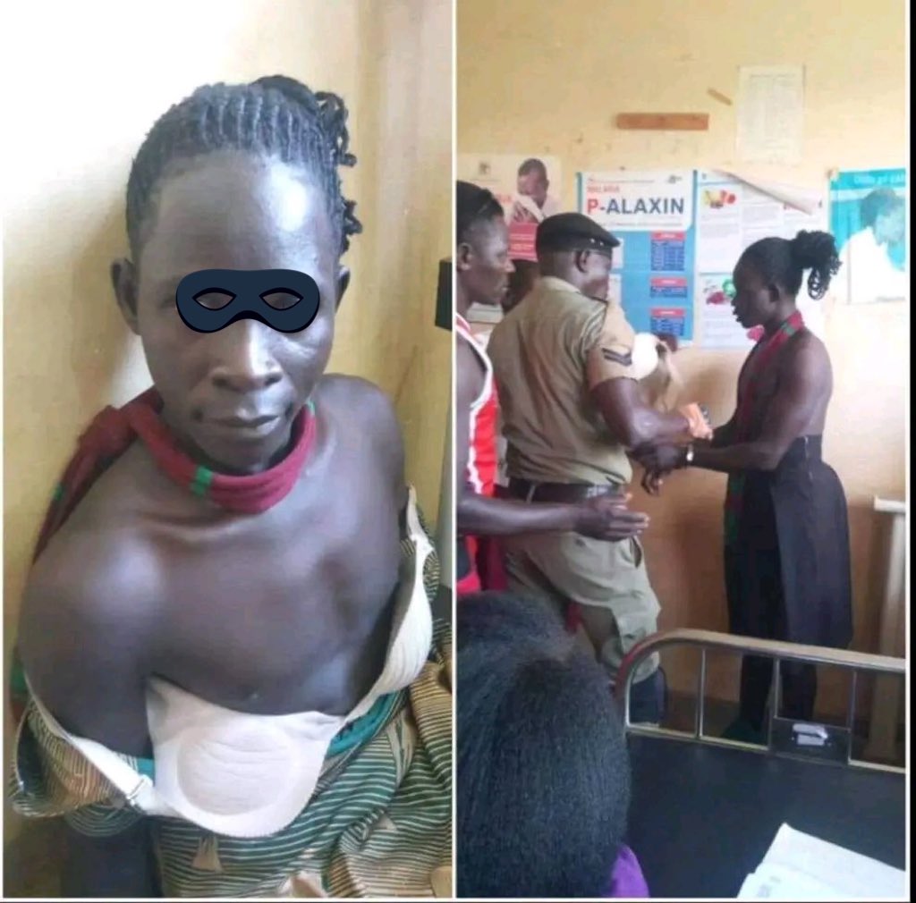 Another Trans woman has been violated as a result of the new #AHA23, lets all stand to fight for Trans rights and #RepealAHA23 to save Trans lives in Uganda. #TransLivesMatter #TransWomenAreWomen