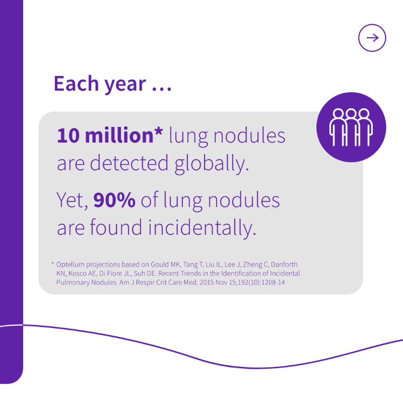 GEHealthCare's tweet photo. Lung cancer impacts more people than any other form of the disease. With the help of #AI devices, clinicians now have the tools to detect nodules early through more accurate diagnoses, helping patients receive the right treatment as soon as possible 👉 https://t.co/wBZfQ9xs5x