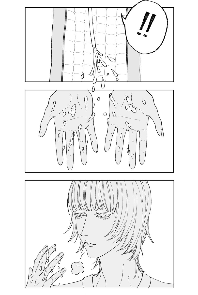 脊髄損傷 ※お漏らし (2/2) 