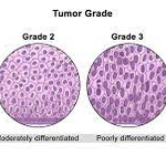 Photo by Journal of Cancer Research and Immuno-Oncology (@immunooncol)