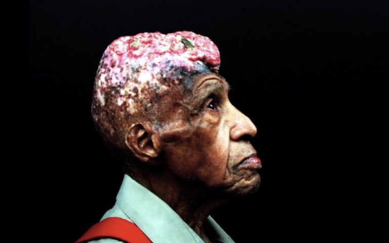 Dear Americans of All Other Races,
Many of the protections you have in terms of medical autonomy &amp; mandatory consent are directly related to Black Americans fighting against inhumane acts performed against us. It’s more than Tuskegee. It’s Henrietta Lacks, Vertus Hardiman, &amp; more