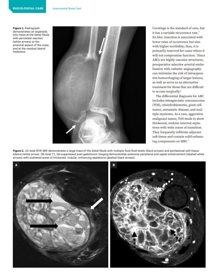 Attention Medical Professionals! If you have an interesting radiology article or case, share it with us, you could get published! More👉bit.ly/3qDCpva

#MedStudent #FutureRadRes #RadRes #RadFellow #Radiologist #AbRad #ERrad #BreastRad #IRad #VIR #NeuroRad #MSK #PedsRad