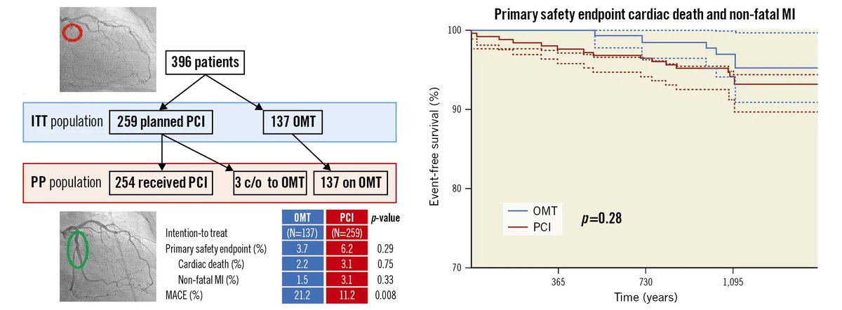 EuroCTO 3-yr outcomes of RCT comparing CTO PCI to OMT In @EuroInterventio PCI associated with: 💙85% success rate 💙Less ischemia-driven revasc 💙No diffeence AMI 💙No difference CV death 👀rb.gy/ej08f