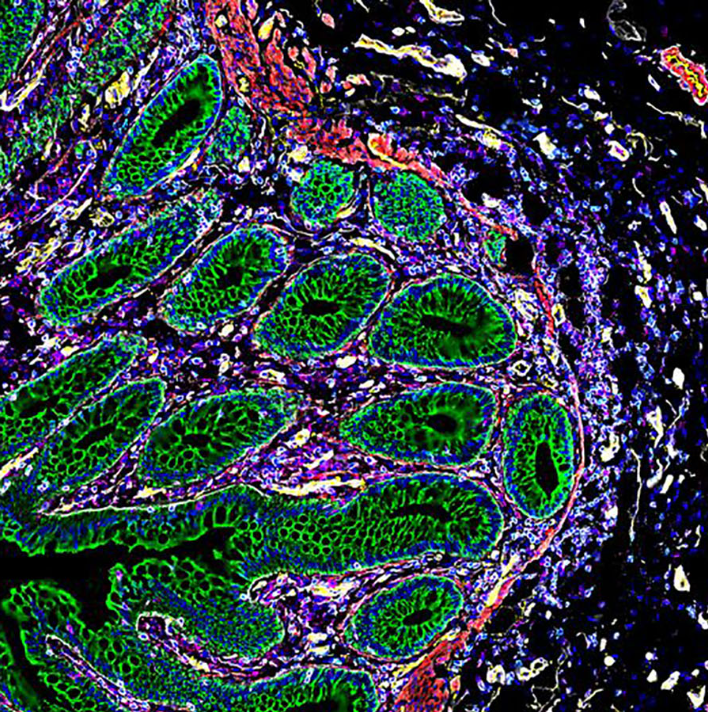 Akoya Biosciences (@akoyabio) on Twitter photo It’s a beautiful day in the intestinal neighborhood! 🚎🥼
This is a #PhenoCycler image of the #intestines, courtesy of <a href="/JohnHickey22/">John Hickey</a>.
"Looking at the presence or absence of a #singlecell doesn't tell you much; it's how cells are grouped together that defines their It’s a beautiful day in the intestinal neighborhood! 🚎🥼
This is a #PhenoCycler image of the #intestines, courtesy of <a href="/JohnHickey22/">John Hickey</a>.
"Looking at the presence or absence of a #singlecell doesn't tell you much; it's how cells are grouped together that defines their