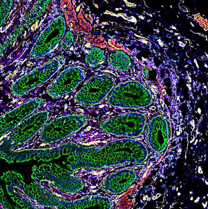 It’s a beautiful day in the intestinal neighborhood! 🚎🥼 This is a #PhenoCycler image of the #intestines, courtesy of @JohnHickey22. 'Looking at the presence or absence of a #singlecell doesn't tell you much; it's how cells are grouped together that defines their…