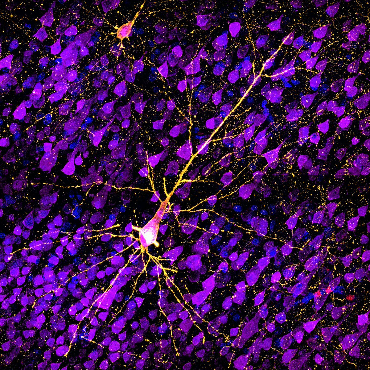 Slow death: misfolded tau accumulating in pyramidal neurons of the temporal neocortex in a monkey model of #Alzheimers. Markers: 🔵dapi🟣neun🟡pTau S422🔴ThioS. #neuroscience <a href="/zeiss_micro/">ZEISS Microscopy</a> #sciart