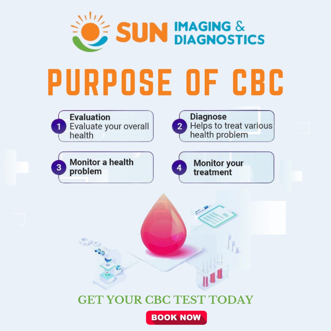 ImagingSun's tweet image. 🔬🌞 Discover the Power of Knowledge: The CBC Test at Sun Imaging and Diagnostics! 🌟💡

 The Complete Blood Count (CBC) test is a powerful tool that provides valuable information about your overall health. 

#SunImagingAndDiagnostics #CBCtest #PowerOfKnowledge #HealthInsights