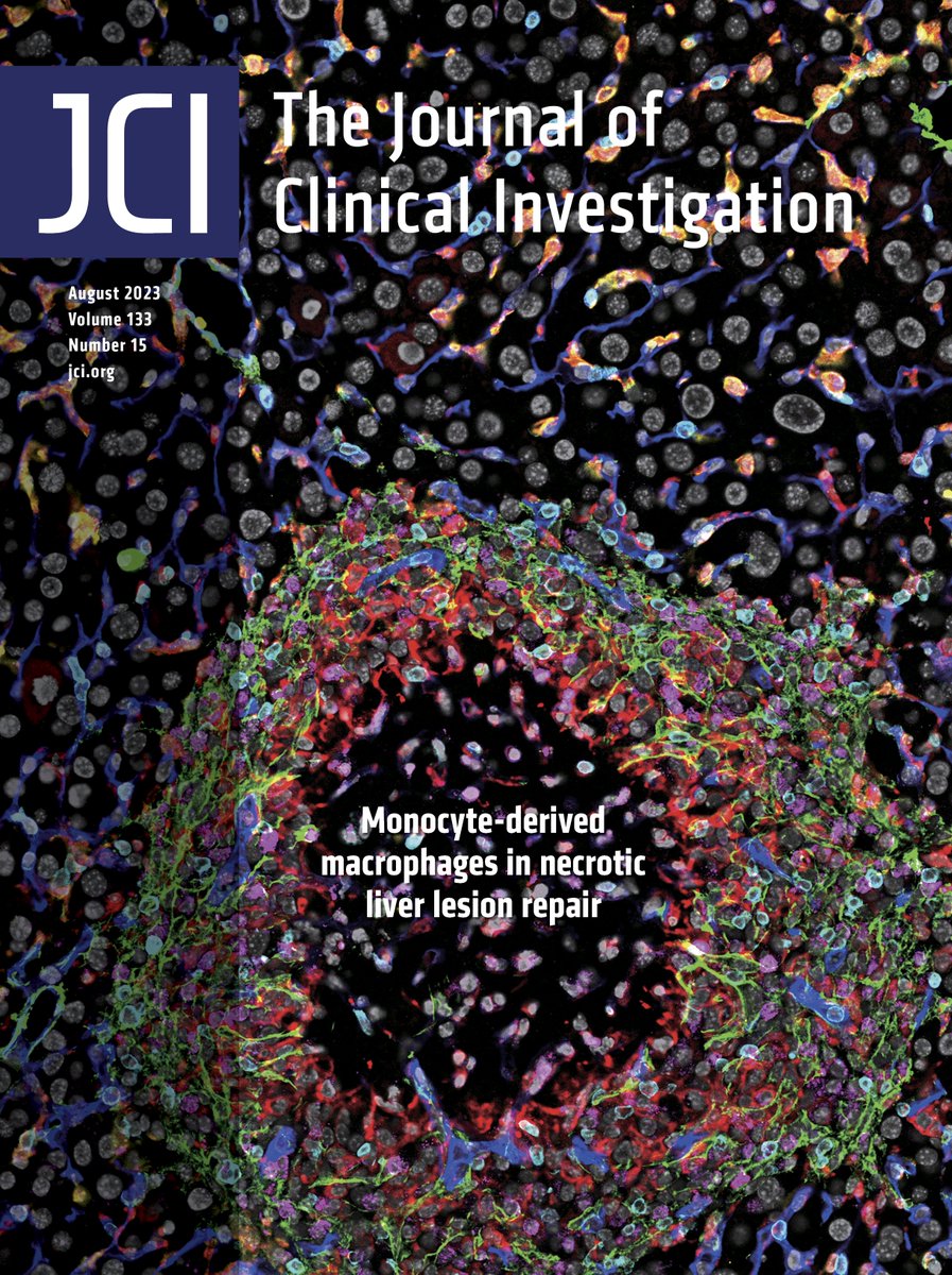 #Cover: Monocyte-derived macrophages in necrotic liver lesion repair: buff.ly/3KivBtG 
Image: multiplex immunofluorescence staining of liver tissue 96 hours after concanavalin A–induced liver injury. 
<a href="/NIAAAnews/">NIAAA News</a> 
#Gastroenterology #Hepatology