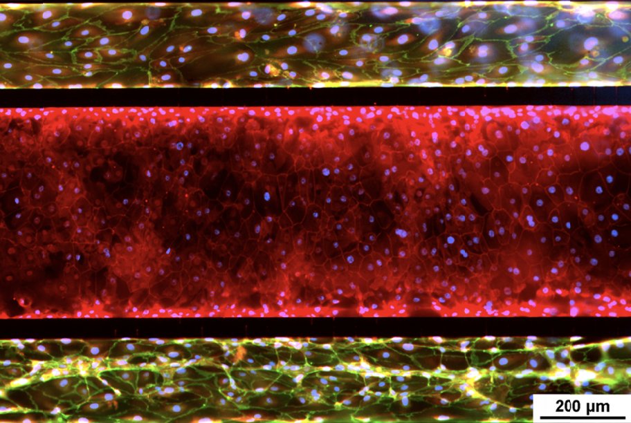 August 1st is World Lung Cancer Day. Lung cancer continues to be one of the most common cancers worldwide. The image below shows the SynALI small airway lung model co-culture of human bronchial epithelial cells and lung microvascular endothelial cells published by Liu et al, 2019