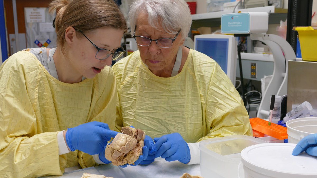HLI at St Paul's (@hlistpauls) on Twitter photo Meet Sylvia, the grandmother of Katrina Besler, a MD/PhD candidate in Dr. Gordon Francisβ lab, who visited the <a href="/HLI_BMCB/">Bruce McManus Cardiovascular Biobank</a> to view human hearts archived for research purposes. Meet Sylvia, the grandmother of Katrina Besler, a MD/PhD candidate in Dr. Gordon Francisβ lab, who visited the <a href="/HLI_BMCB/">Bruce McManus Cardiovascular Biobank</a> to view human hearts archived for research purposes.