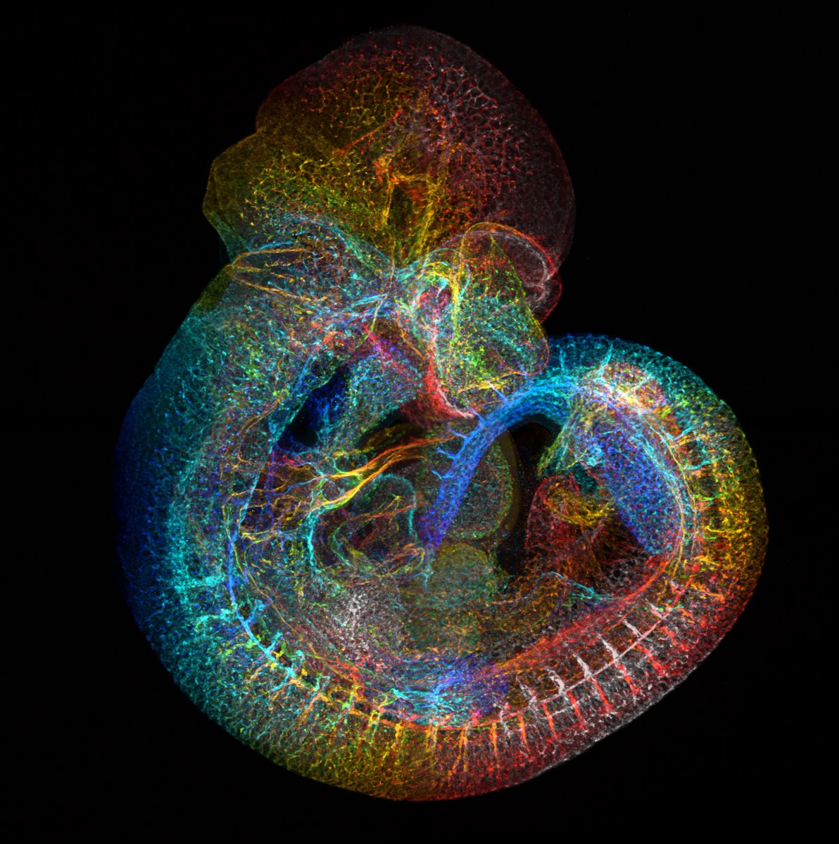 Dave Grainger (@degrainger123) on Twitter photo We have a research assistant position available to work with me and <a href="/StoneOliverA/">oliver stone</a>. Join us to help set up in vitro models of human lymphatic endothelial cell development! Working in <a href="/OxfordDPAG/">Department of Physiology Anatomy & Genetics (DPAG)</a> at the <a href="/IdrmOxford/">Oxford_IDRM</a>.
Details: tinyurl.com/StoneGroupRA
<a href="/the_Node/">the Node</a> #devbio #stemcells We have a research assistant position available to work with me and <a href="/StoneOliverA/">oliver stone</a>. Join us to help set up in vitro models of human lymphatic endothelial cell development! Working in <a href="/OxfordDPAG/">Department of Physiology Anatomy & Genetics (DPAG)</a> at the <a href="/IdrmOxford/">Oxford_IDRM</a>.
Details: tinyurl.com/StoneGroupRA
<a href="/the_Node/">the Node</a> #devbio #stemcells