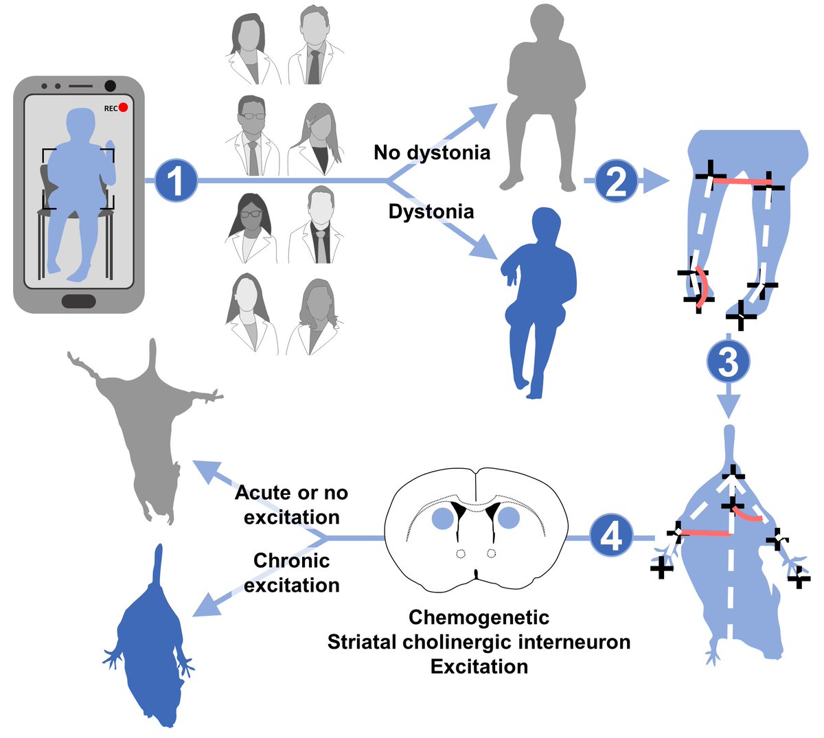 drbhooma's tweet photo. 1/ Proud to share this pre-print, spanning studies from the #cerebralpalsy clinic to mice in the lab, demonstrating a causative link between chronic striatal cholinergic interneuron excitation and #dystonia. https://t.co/StEhmhPb8f https://t.co/HYWffbawrd