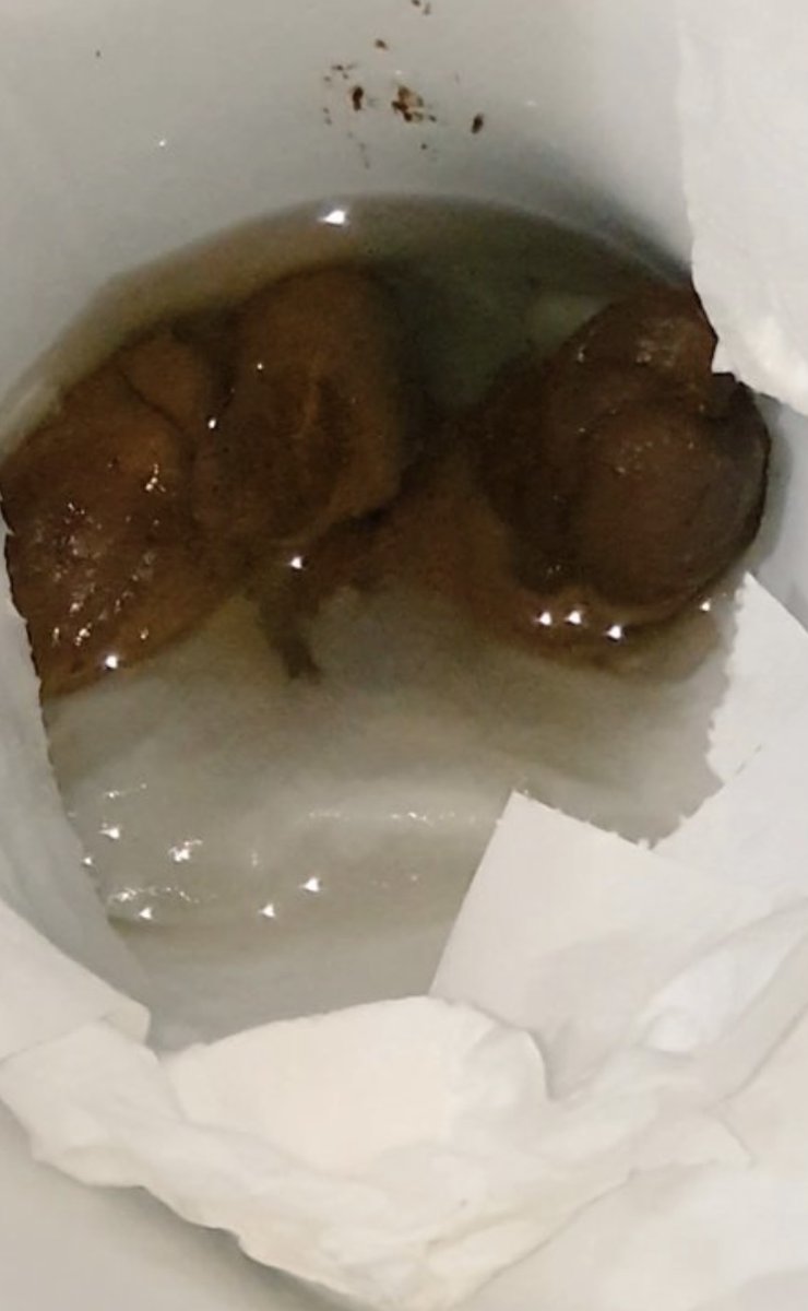 Stoke fan at Cardiff from March 2022. Good effort and very big. Looks good. 8/10 #poo