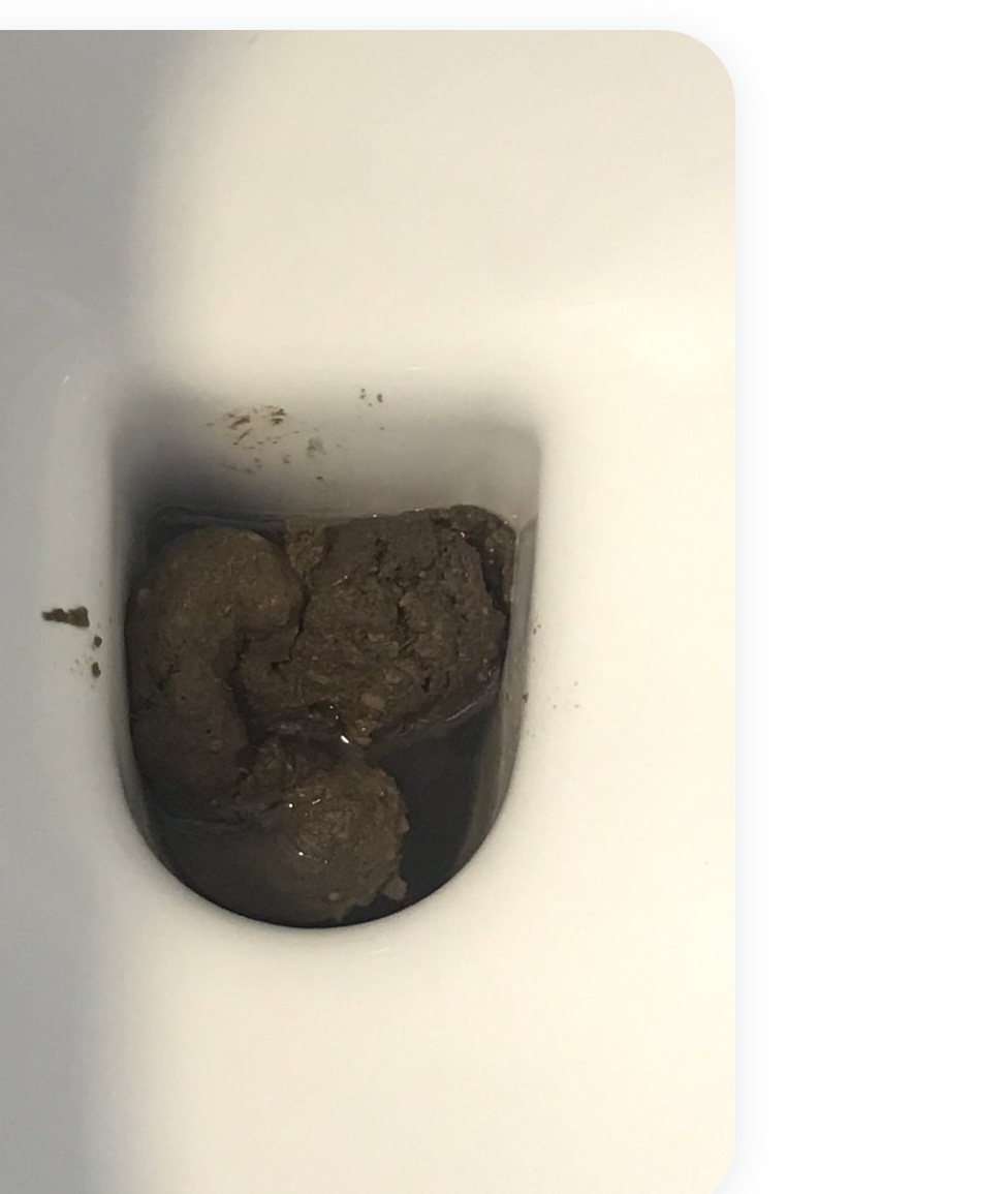 Leicester fan before the last game against West Ham. Can understand why he let this out seeing as they went down after this game. Can’t say I feel bad for Leicester. Hate them seeing as I am a Derby fan. 7/10 #poo
