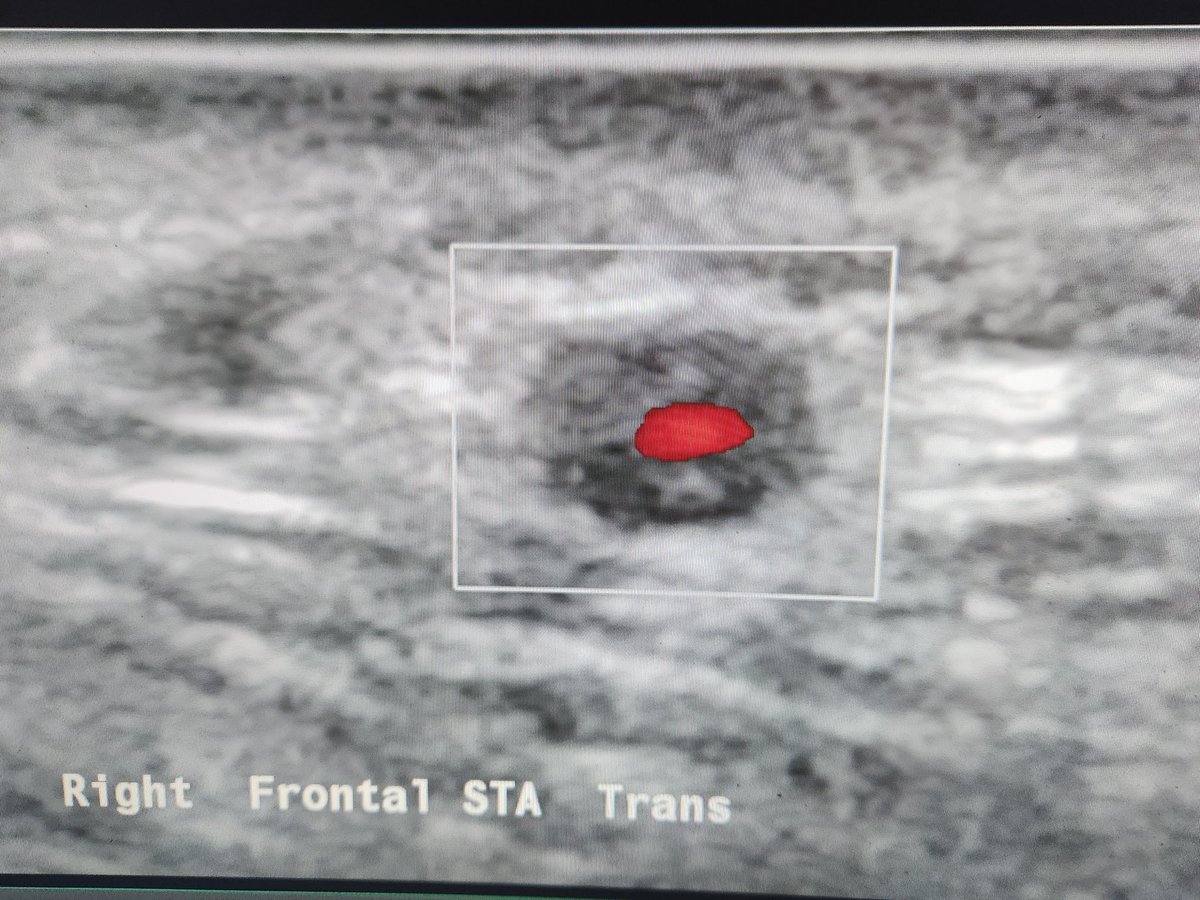 Adrian Fawcett tweet media