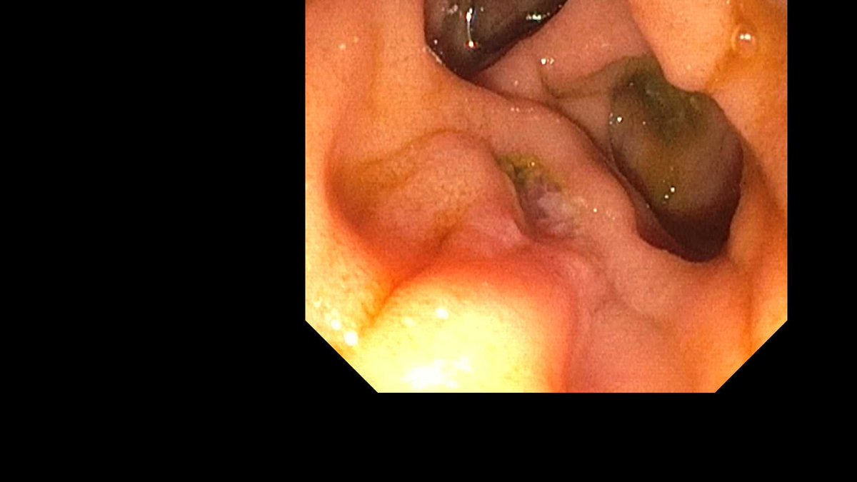 Douglas G. Adler MD, FASGE, FACG, AGAF tweet media