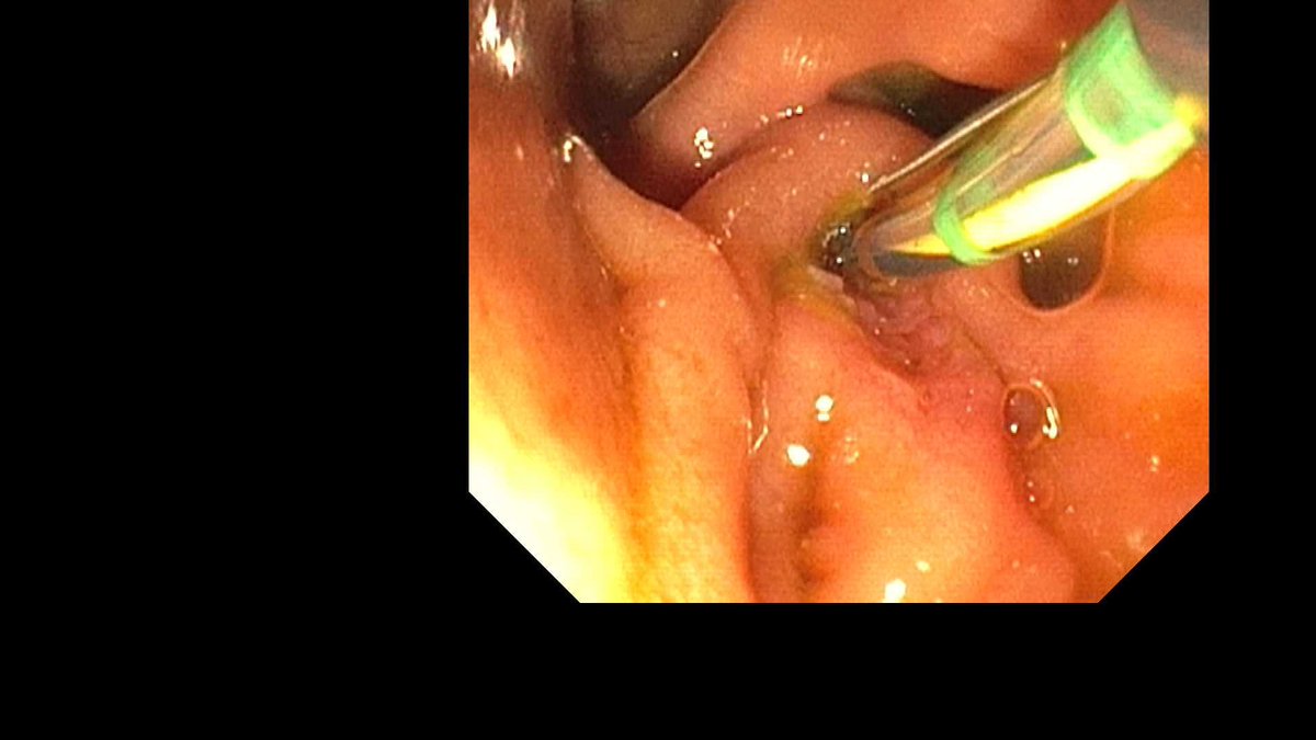 Douglas G. Adler MD, FASGE, FACG, AGAF tweet media