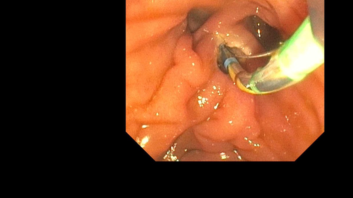 Douglas G. Adler MD, FASGE, FACG, AGAF tweet media