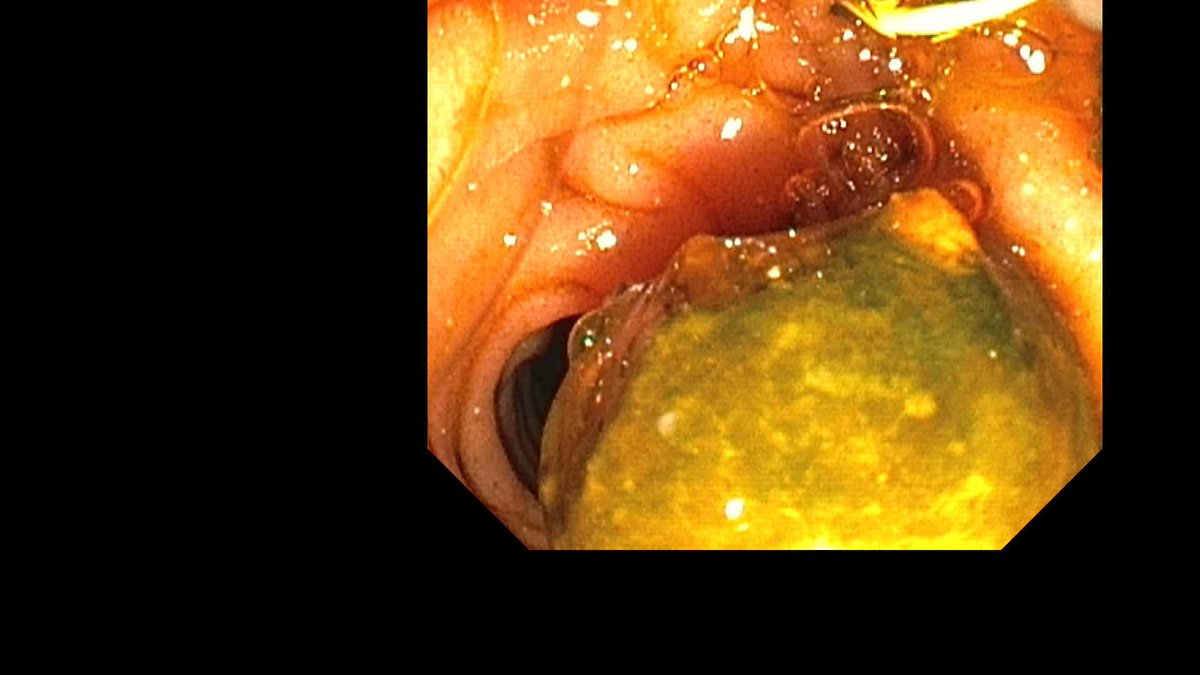 Douglas G. Adler MD, FASGE, FACG, AGAF tweet media