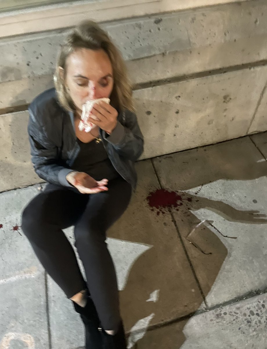 rationalinpdx's tweet photo. My dear friend Mary, a radiologist who lives in Portland, was beaten with a metal water bottle and knocked unconscious on Friday night 7/28 near the Providence Park MAX stop. She was brave enough to talk about it and allowed me to share these photos. 
https://t.co/mvV9GCVQ0c https://t.co/ZS3w30madu
