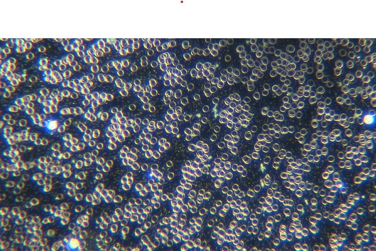 MrArgoN0t's tweet photo. @red_sharon33 @DiedSuddenly_ I did two EDTA chelations with some other stuff and this was the result. https://t.co/5HrILOjRez