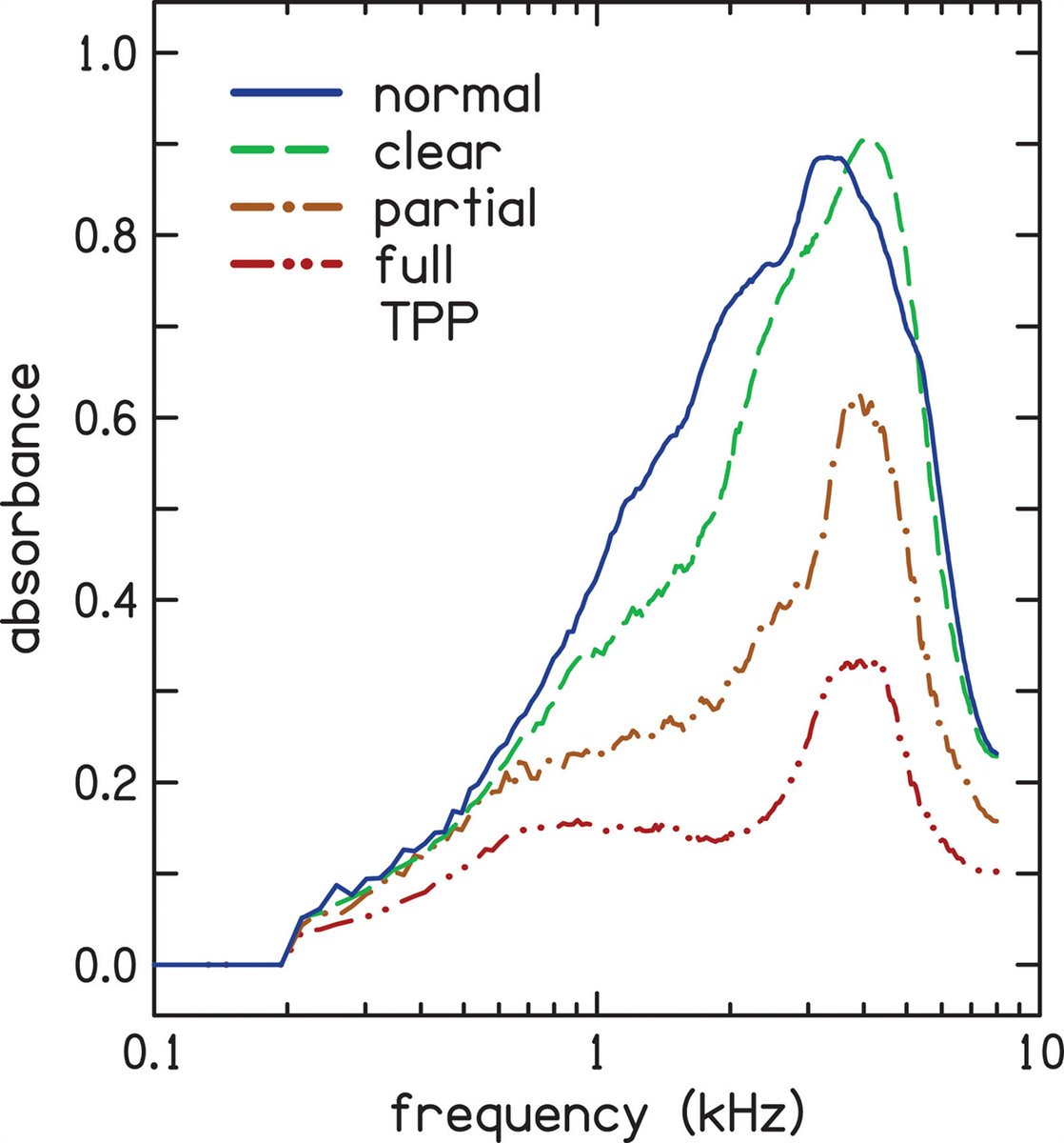 Conductive Hearing Loss Estimated From Wideband Acoustic Immittance Measurements in Ears With Otitis Media With Effusion dlvr.it/St4RSH