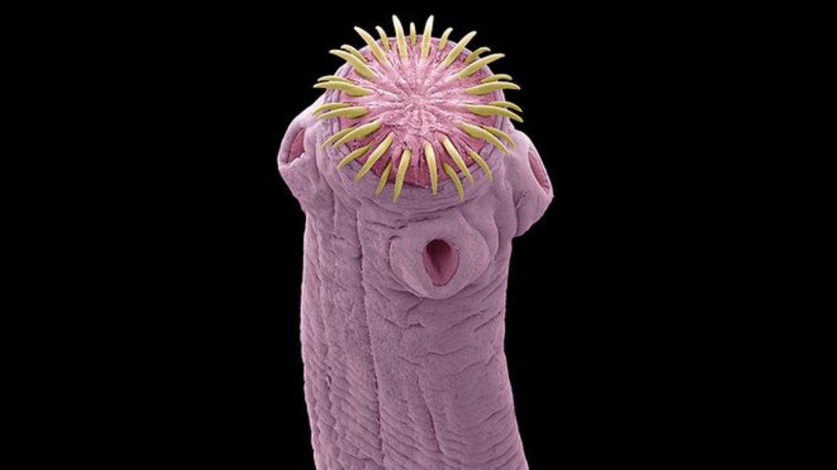 𝐖𝐇𝐀𝐓 𝐈𝐅 Internal Parasites Are Silently 𝐇𝐀𝐑𝐌𝐈𝐍𝐆 Your Body? Parasites