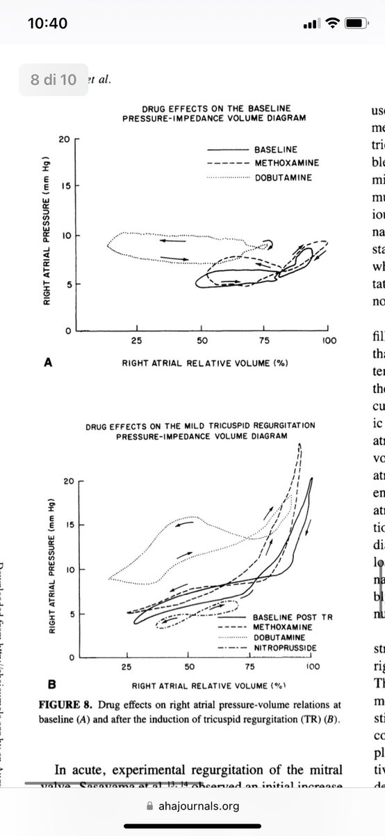 MARA Gavazzoni (@gavazzoni_mara) on Twitter photo Circulation 1986. TR, RA mechanics and the effect of drugs(+~ pre and afterload)
Old lesson but the base of some issues in clinical practice and inspiring new evidence on imaging for RA function.
<a href="/lpbadano/">Luigi</a> <a href="/cascella_andrea/">Andrea Cascella</a> <a href="/denisamuraru/">Denisa Muraru</a> <a href="/CaravitaSergio/">Sergio Caravita</a> <a href="/michetomaselli/">Michele Tomaselli</a> Circulation 1986. TR, RA mechanics and the effect of drugs(+~ pre and afterload)
Old lesson but the base of some issues in clinical practice and inspiring new evidence on imaging for RA function.
<a href="/lpbadano/">Luigi</a> <a href="/cascella_andrea/">Andrea Cascella</a> <a href="/denisamuraru/">Denisa Muraru</a> <a href="/CaravitaSergio/">Sergio Caravita</a> <a href="/michetomaselli/">Michele Tomaselli</a>