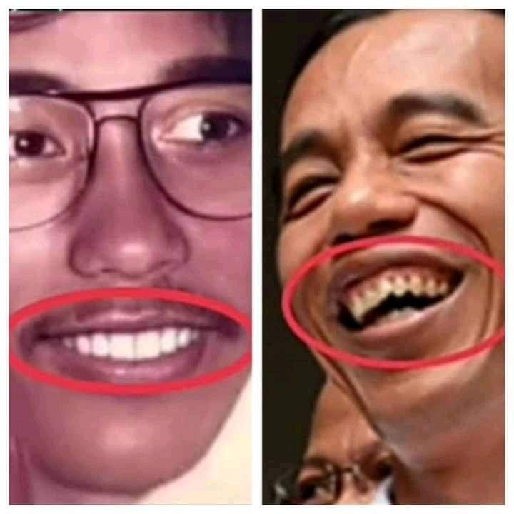 *Ijasah bisa dipalsuin.*
*Hidung dan bibir bisa dioplas.Kacamata bisa diganti softlens. Lah kalo gigi udah bagus, napa malah diberantakin?*🤣🤣🤣🤭🙄