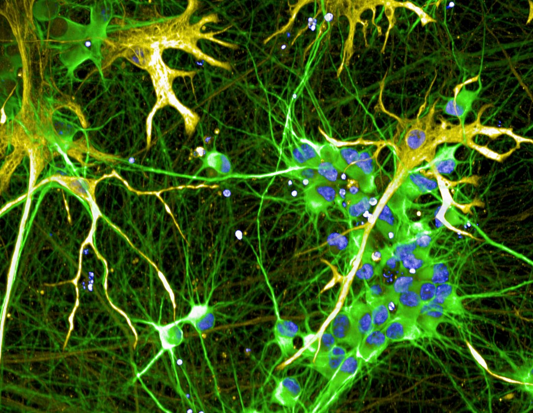 Even the cells are using the colours of the Brazilian Flag 🇧🇷 to support @SelecaoFeminina at the @FIFAWWC. #FIFAWWC #BeyondGreatness #PelaPrimeiraEstrela #emBRAza *Motor Neurons in green, astrocytes in yellow and nuclei in blue.
