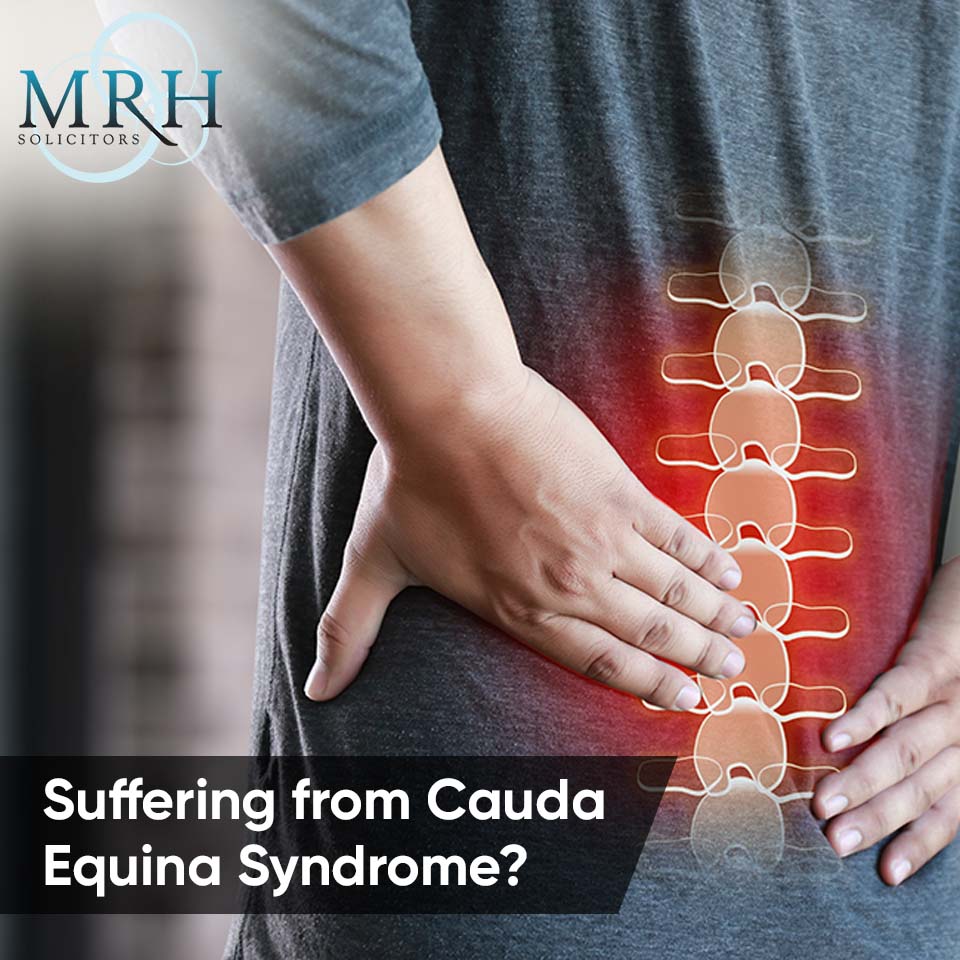 Suffering from Cauda Equina Syndrome? 

Take the first step towards healing today – contact MRH Solicitors for a consultation.

Know more: mrhsolicitors.co.uk/service/cauda-…

#CaudaEquinaSyndrome #MedicalNegligence #MRHSolicitors #LegalSupport #ClaimsServices #linkedin #LegalSupport