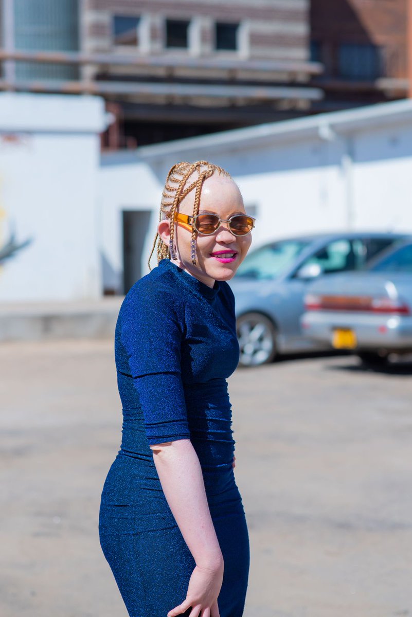 My #WomanWithADisability #WCW is gentle <a href="/SSanelisile/">Sanelisile Sithandazile</a> Musicable Project Mentee
Sane is living beyond her disability &amp;she's chasing her dream to be #ZimBestFemale musician. Sane hasn't allowed her hearing impairment condition&amp;all barriers faced by #PeopleWithAlbinism to stop her