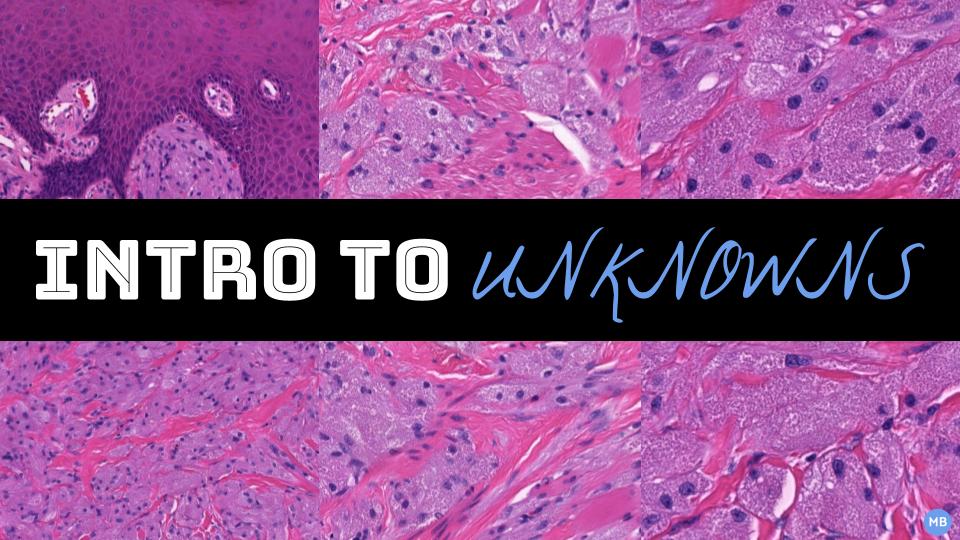 In my last video, I briefly discussed my method for approaching &amp; describing unknowns cases...

I also figured that it would make a great #pathtweetorial!

1/