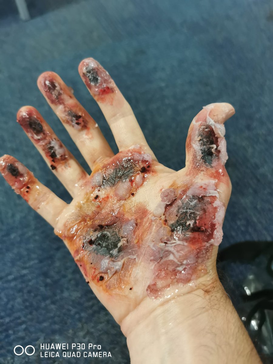 Simu_Seb's tweet image. Brilliant day with @stephdavey_1 and @cifascullion learning new moulage techniques at @NandM_Keele for an upcoming simulation. 
#Simulation