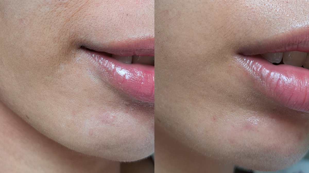 😔 Pake Retinol emang se-danget itu? ❌❌❌

Kulitku jadi dehidrasi pisunnnnn😭 

#racuninskincare