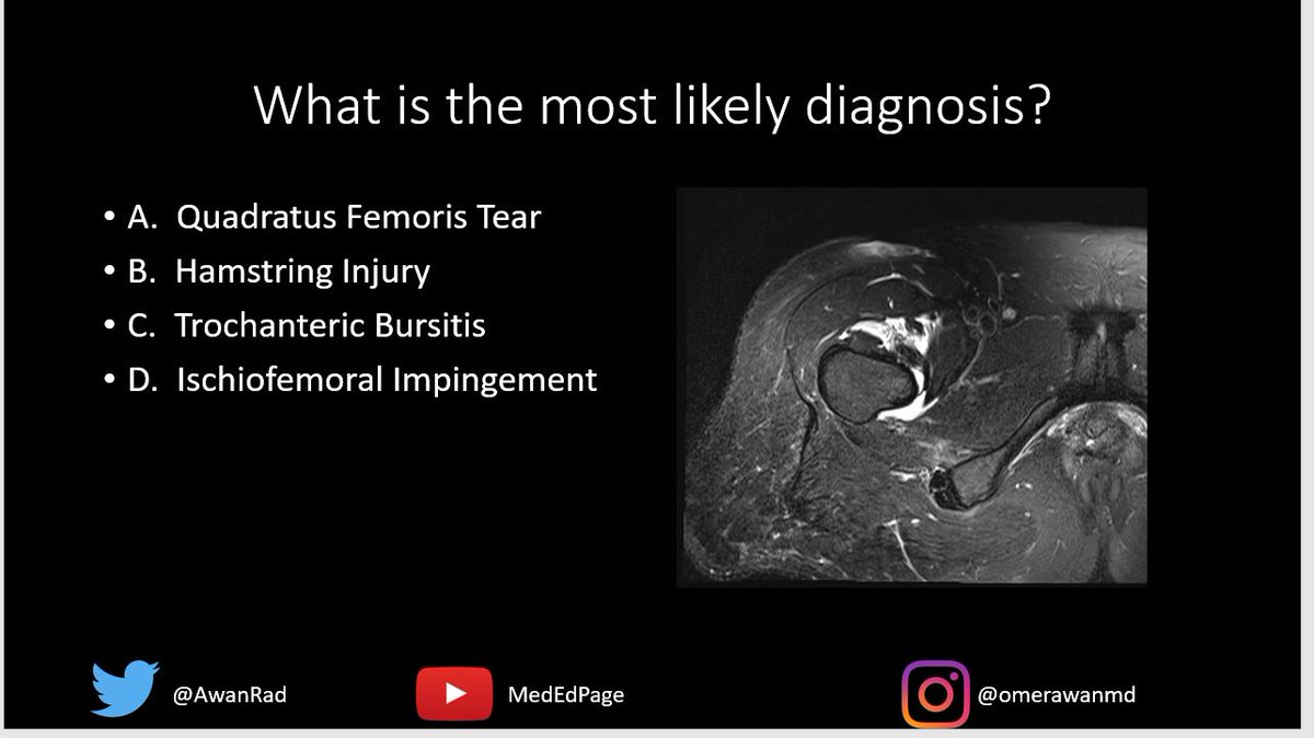 MSK CASE #91- Learn and Have Fun!  youtube.com/watch?v=CL0BK-….  #MedTwitter #MedEd <a href="/_the_SRT/">The Society of Radiologists in Training</a> <a href="/ESSRmsk/">European Society of Musculoskeletal Radiology</a> <a href="/skeletalrad/">Angel Gómez-Cintrón, MD, MPH</a> @jennybencardino <a href="/mahad_minhas/">M&M, MD, MPH</a> <a href="/VivekKaliaMD/">Vivek Kalia, MD MPH</a> <a href="/nyu_mskrad/">NYU_MSK Radiology</a> <a href="/Dx_imaging/">Diagnostic Imaging</a> @AliTejaniMD <a href="/AminaFarooqMD/">Amina Farooq</a> <a href="/alihusnain186/">Ali Husnain, MD</a> <a href="/DrFerdowsi/">Sahba Ferdowsi DO (conciergedoc)</a> <a href="/angchoemd/">Angela I. Choe MD FACR</a> <a href="/BethVettiyil/">Beth Vettiyil, M.D.</a>