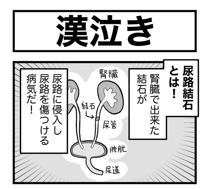 ポンコツ美少女尿路結石おじさんの尿路結石レポートまんがです… 
