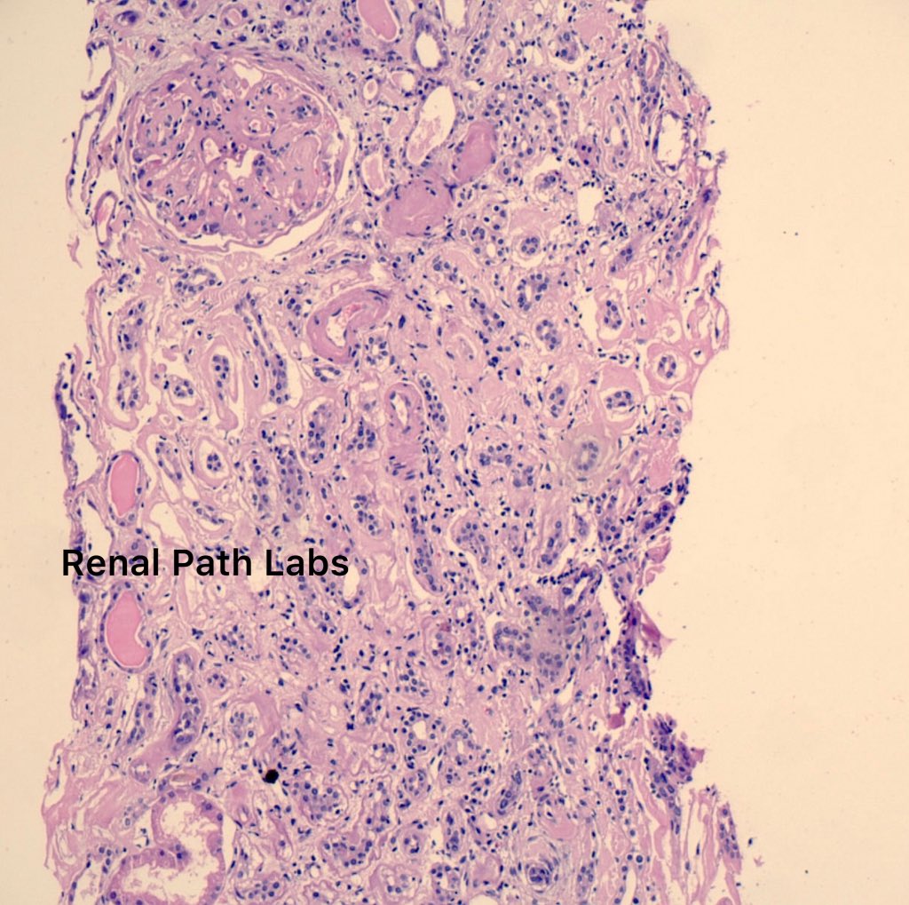 Renal Path Labs tweet media