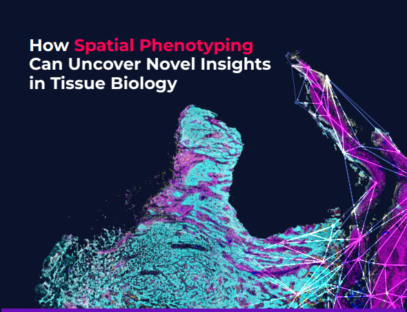 Spatial phenotyping can provide new insights in areas such as #oncology, #immunology, and #neurology. Download our white paper to learn how #spatialphenotyping can uncover novel insights in tissue biology. bit.ly/3CY1nIs #spatialbiology