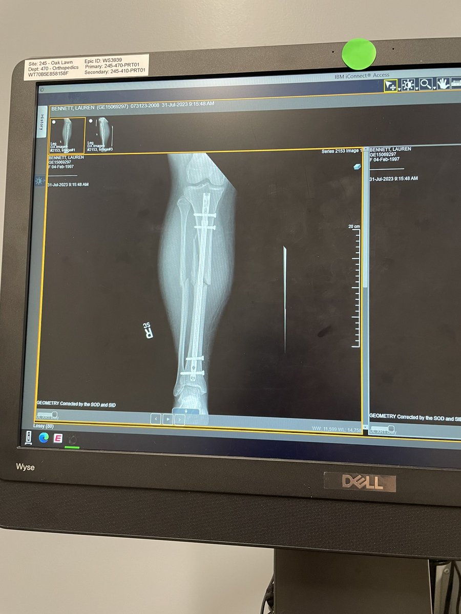 LBENyandthejets's tweet photo. @lollapalooza what are the odds you want to gift a girl who got hit by a car and broke a bunch of bones with some tickets? First thing I said in the ER was “I need to figure out how to get ADA at lolla”

My mom thinks I’m crazy but I can’t fathom missing my 10th year 😭 https://t.co/m6m5dd3RSh