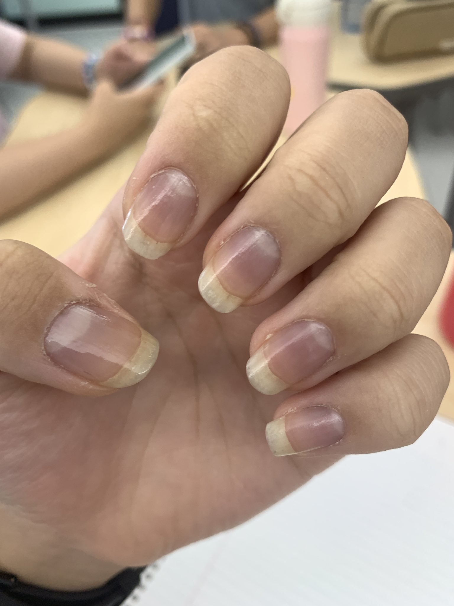 Share more than 144 reasons for nails turning blue super hot ceg.edu.vn