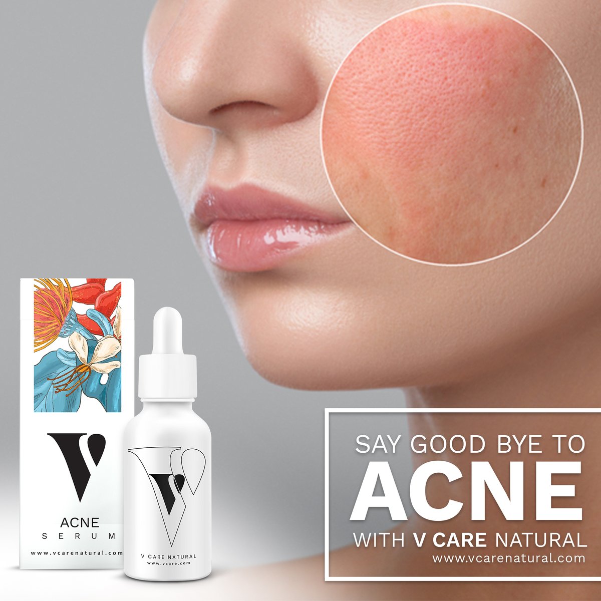 Vcare Natural (@Vcare_Natural) / Posts / X