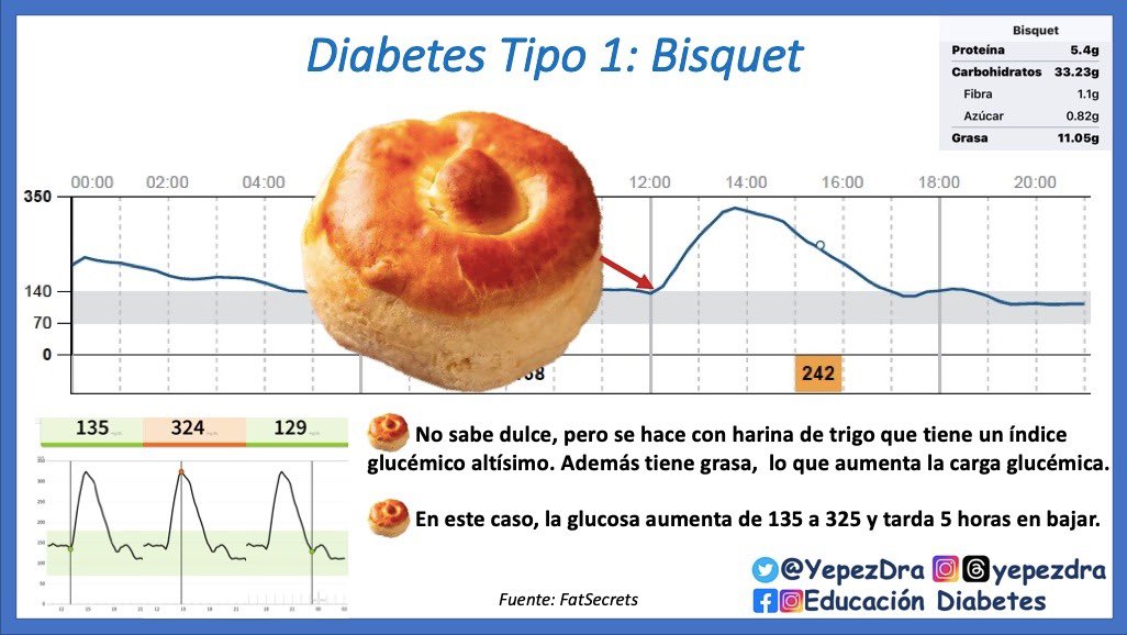 YepezDra's tweet photo. En #Diabetes, el pan tiene un índice glucémico muy alto, y si se prepara con grasa, el impacto es mayor y dura horas. A veces las personas piensan que si no sabe dulce “no afecta tanto” como el bisquet o el 🥐)👇🏼#CGM, #MCG
Pdt: El bisquet es mi favorito 😞 https://t.co/XLMljAKKLC