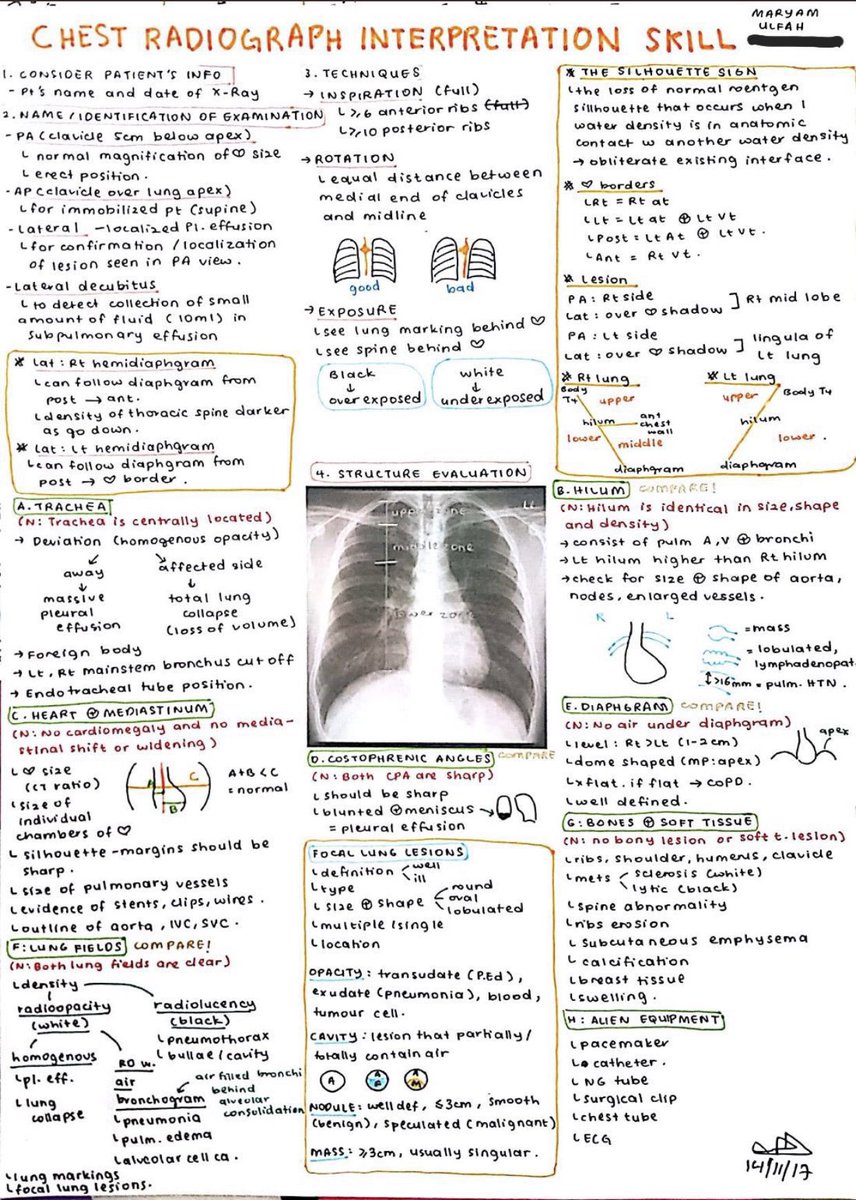 Medical_MD1's tweet photo. Great Notes 🤩

Abdominal &amp; Chest Radiograph interpretation 👌🏼✨

. https://t.co/KHSymwICK2