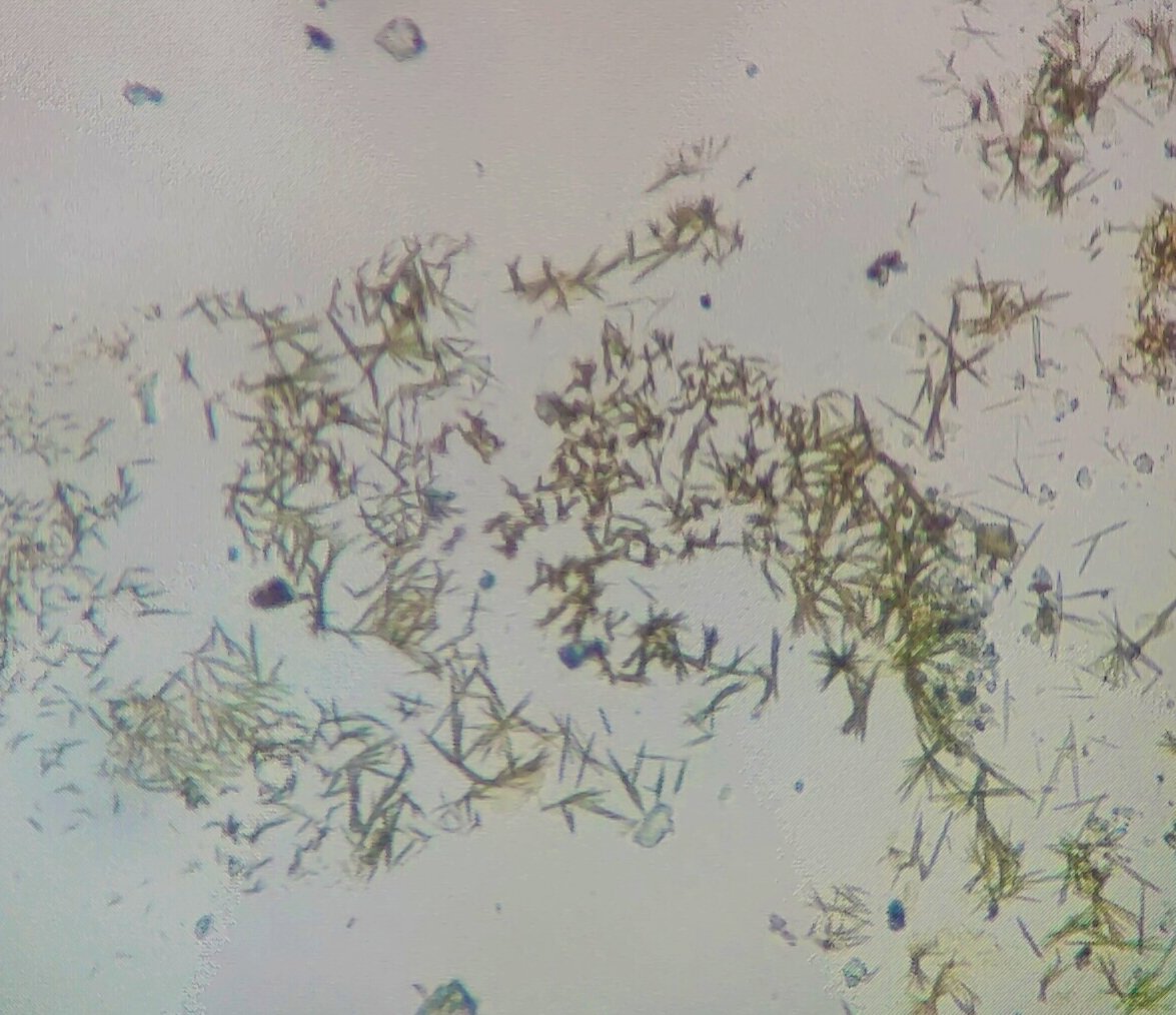 BiologyLums's tweet image. Crystal isolation from Lichens of Skardu valley as a part of #BIO102 lab activity. Lichens crystals are lipids in nature and have traditionally been used for identification. @sbasselums @LifeAtLUMS #LUMSxUOBS23