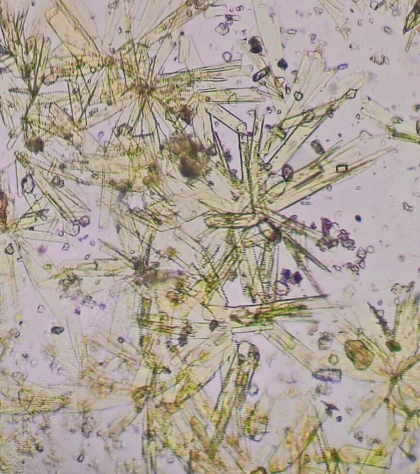 BiologyLums's tweet image. Crystal isolation from Lichens of Skardu valley as a part of #BIO102 lab activity. Lichens crystals are lipids in nature and have traditionally been used for identification. @sbasselums @LifeAtLUMS #LUMSxUOBS23